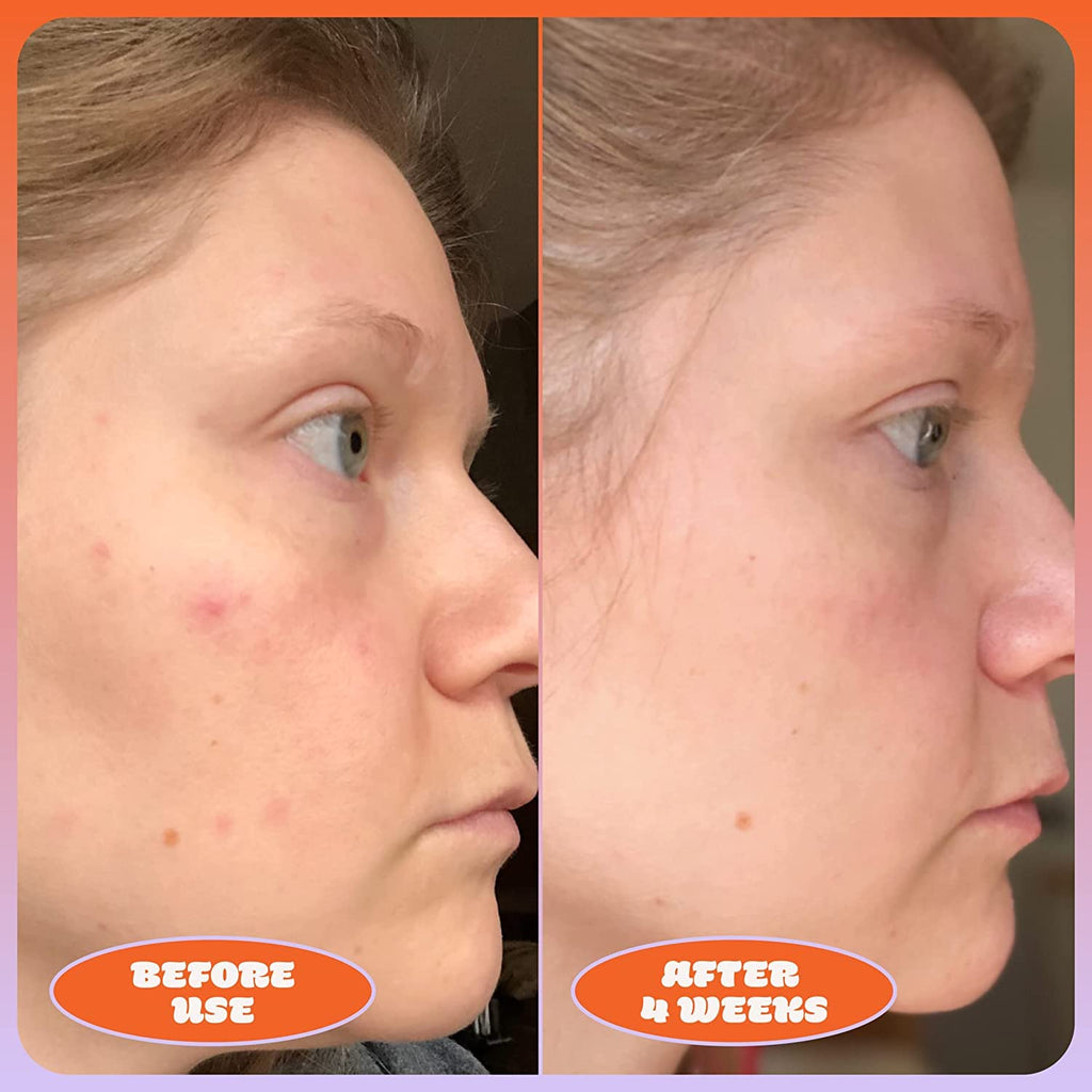 Vitamin C Serum and Blue Tansy Face Oil Duo O3377